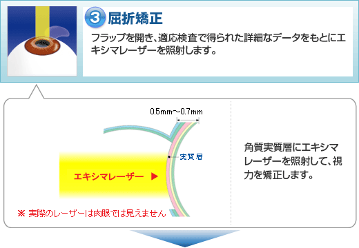 手順3