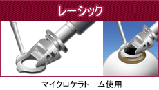 レーシック